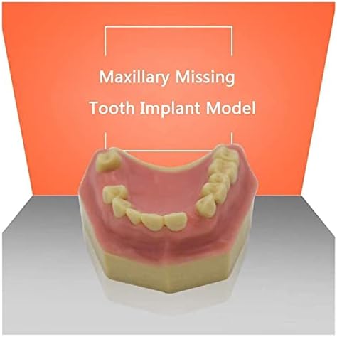 מודל שיניים שיניים של Accduer, מודל מודל שתל אוראלי מודל, מודל שיניים להפגנת השתלת שיניים תרגול הוראה