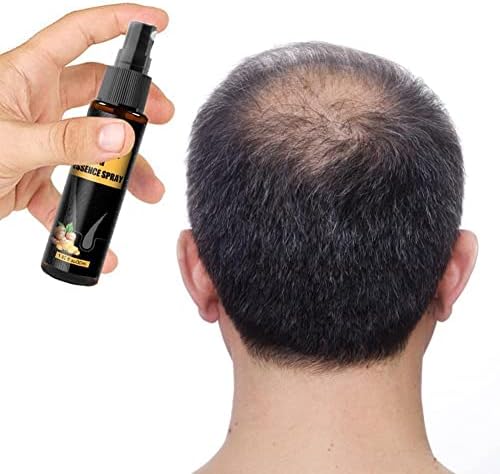 30 מיליליטר צמחים שיער צמיחת תרסיס סט שיער אובדן טיפול מרכך מזין זקן שיער צמיחת שמן תרסיס30 מיליליטר